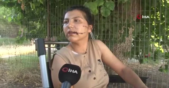 100 yerinden defalarca bıçaklandı, yaşadığı dehşeti böyle anlattı