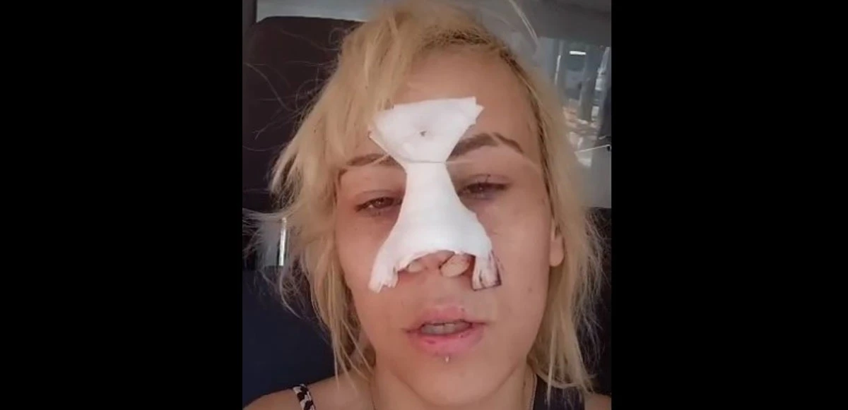 Çakmak istediği kadınlardan ‘yok’ cevabı alınca gözü döndü! O zaman sigaramı nasıl yakacağım?