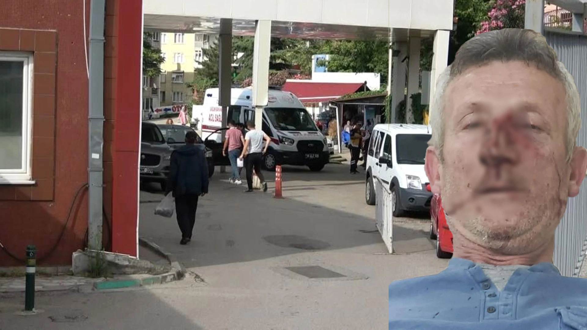 Fahiş aidat zammı eylemine yönetici dayağı: Engelli site sakinini hastanelik etti