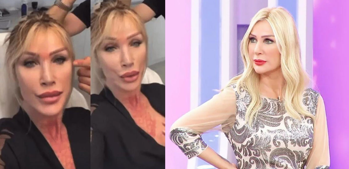 Seda Sayan'ın estetiklerini doktoru say say bitiremedi