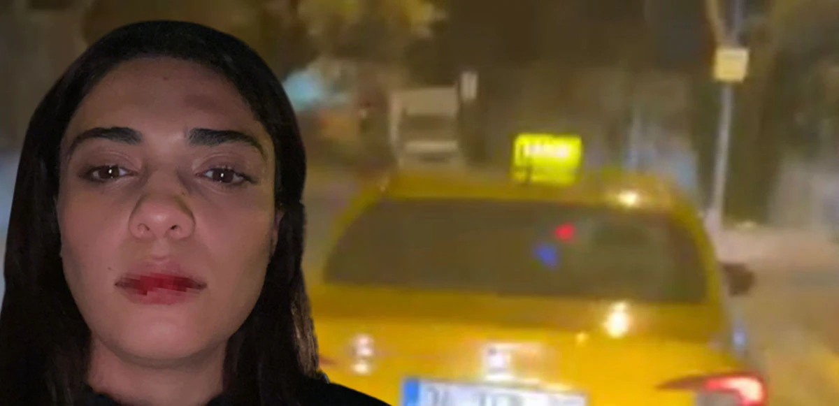 Azerbaycanlı şarkıcı Nergiz Bagieva İstanbul'da kendisini çarpan taksicinin saldırısına uğradı!