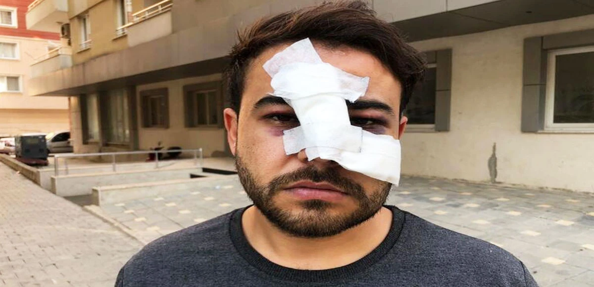 İkinci istek şarkı vakası!  Yüzünde şişe kırılan müzisyen Yusuf Karagündüz o anları TGRT Haber'de anlattı