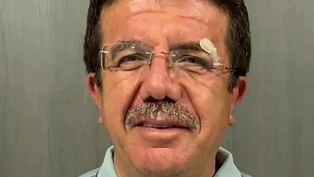 Kazada yaralanan eski bakan Zeybekci'den mesaj
