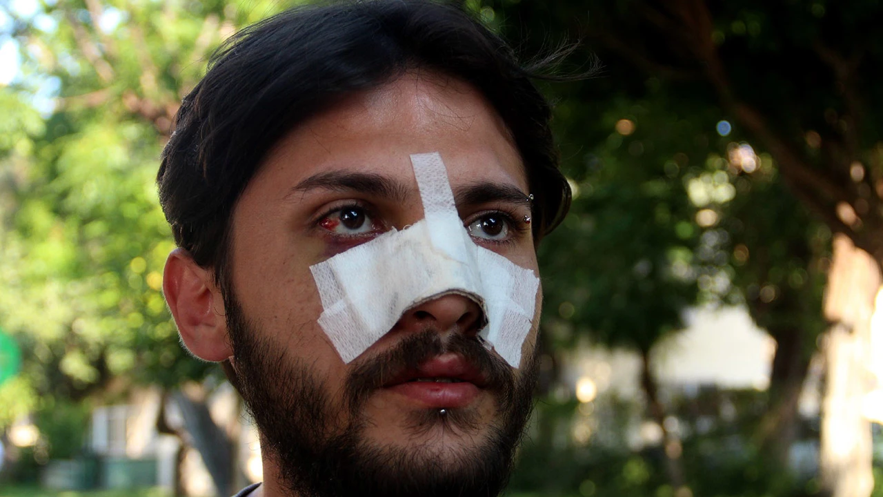 Antalya'da 'ucuz kira' dayağı