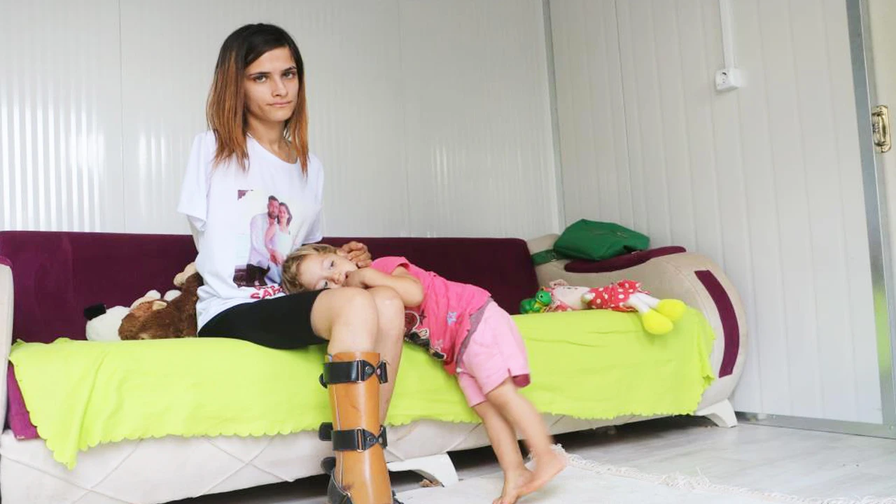 Depremde kolunu kaybetti! Kızına sarılmak için biyonik kol istiyor