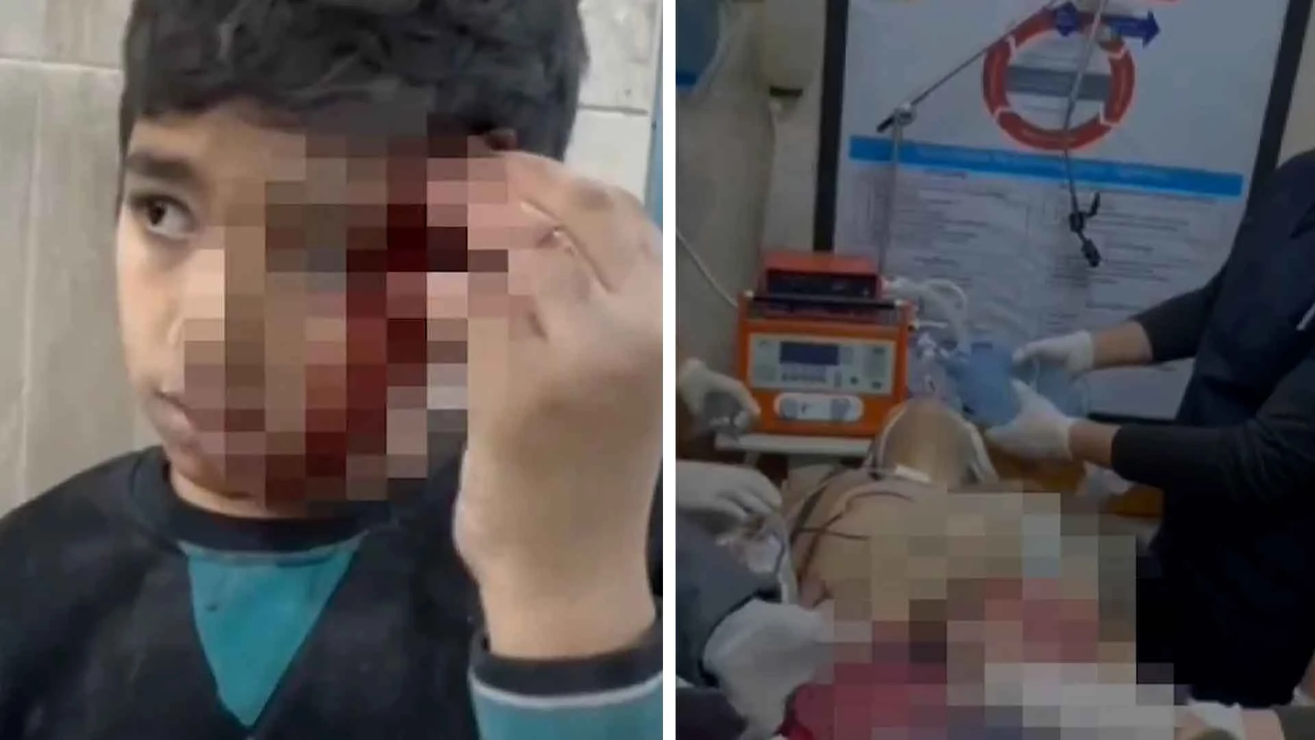 Ateşkes bitti, İsrail yine namluları çocuklara yöneltti!