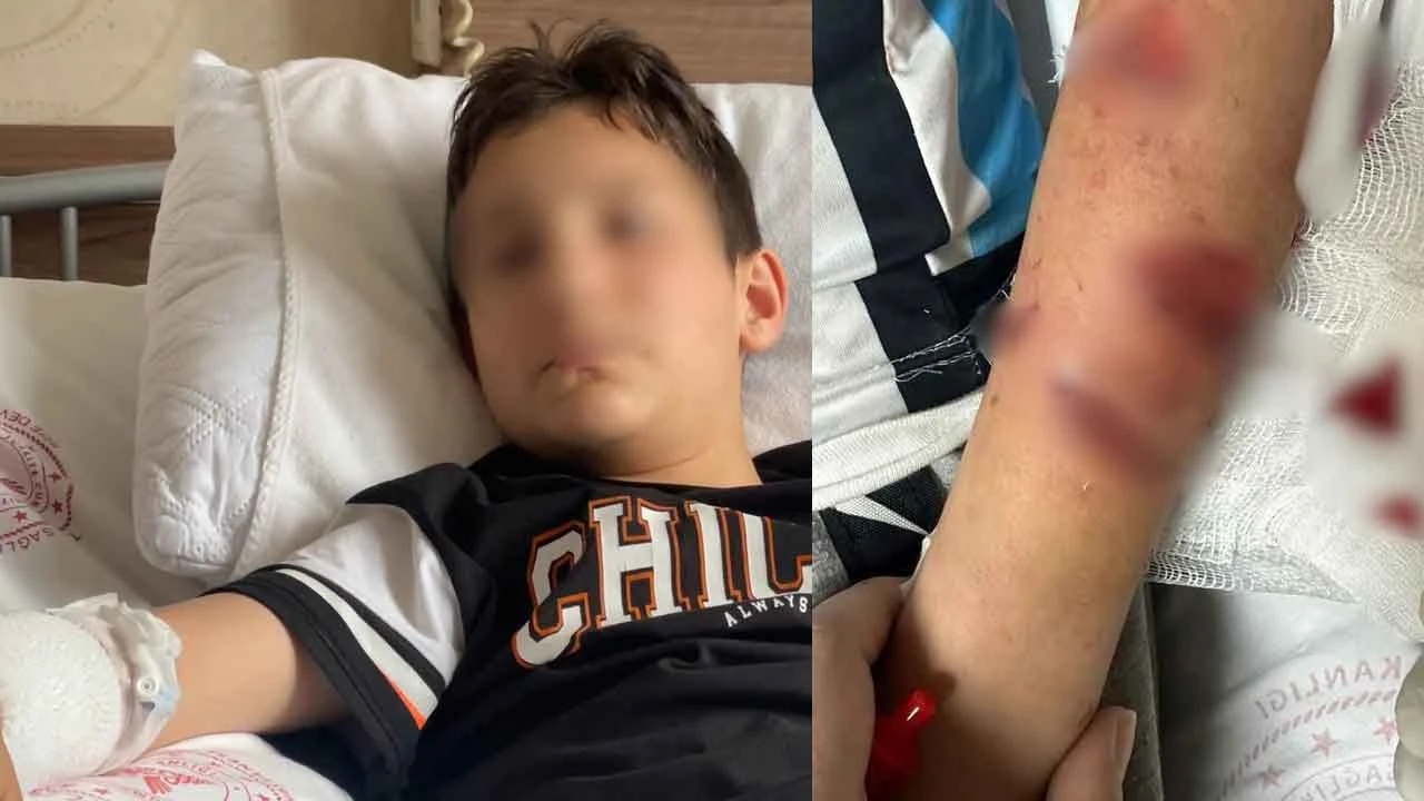 Her zaman beslediği köpek bir anda saldırdı 12 yaşındaki çocuk o anları anlattı