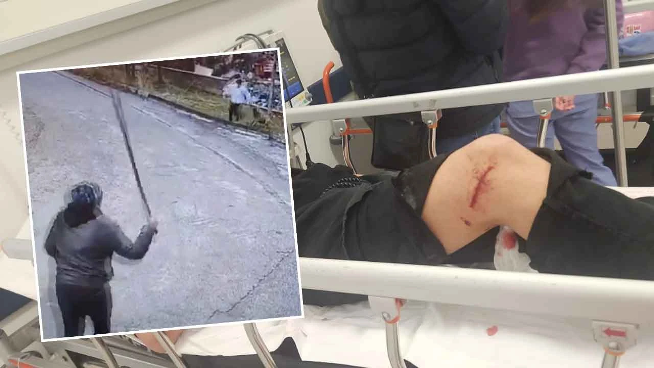 Ankara'da okula giden çocuğa köpekler saldırdı öğretmeni sopayla yardımına koştu