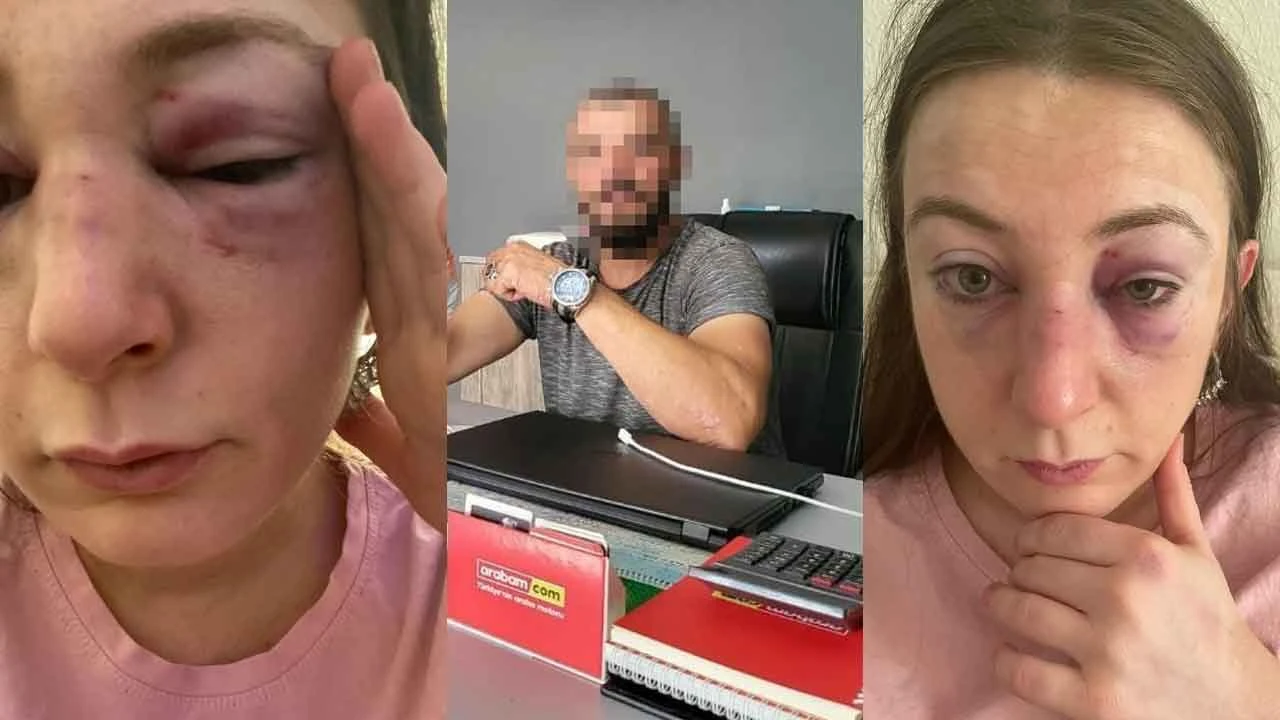Eğlence merkezinde eski kız arkadaşını görünce yumrukladı! Her yumruğa 1 yıl ceza