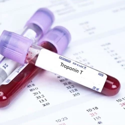 Kalp Sağlığının Anahtarı: Troponin - Aktüel