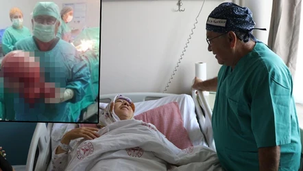 Görenler hamile sanıyordu! İçinden çıkana doktor bile şaşırdı - Gündem