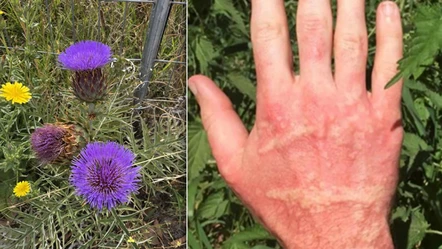 Dokunanı yakan istilacı bitki ülkenin sorunu haline geldi! Uzmanlardan uyarı geldi - Dünya