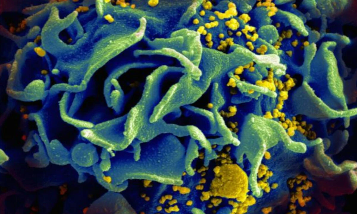 Çok daha öldürücü HIV varyantı bulundu