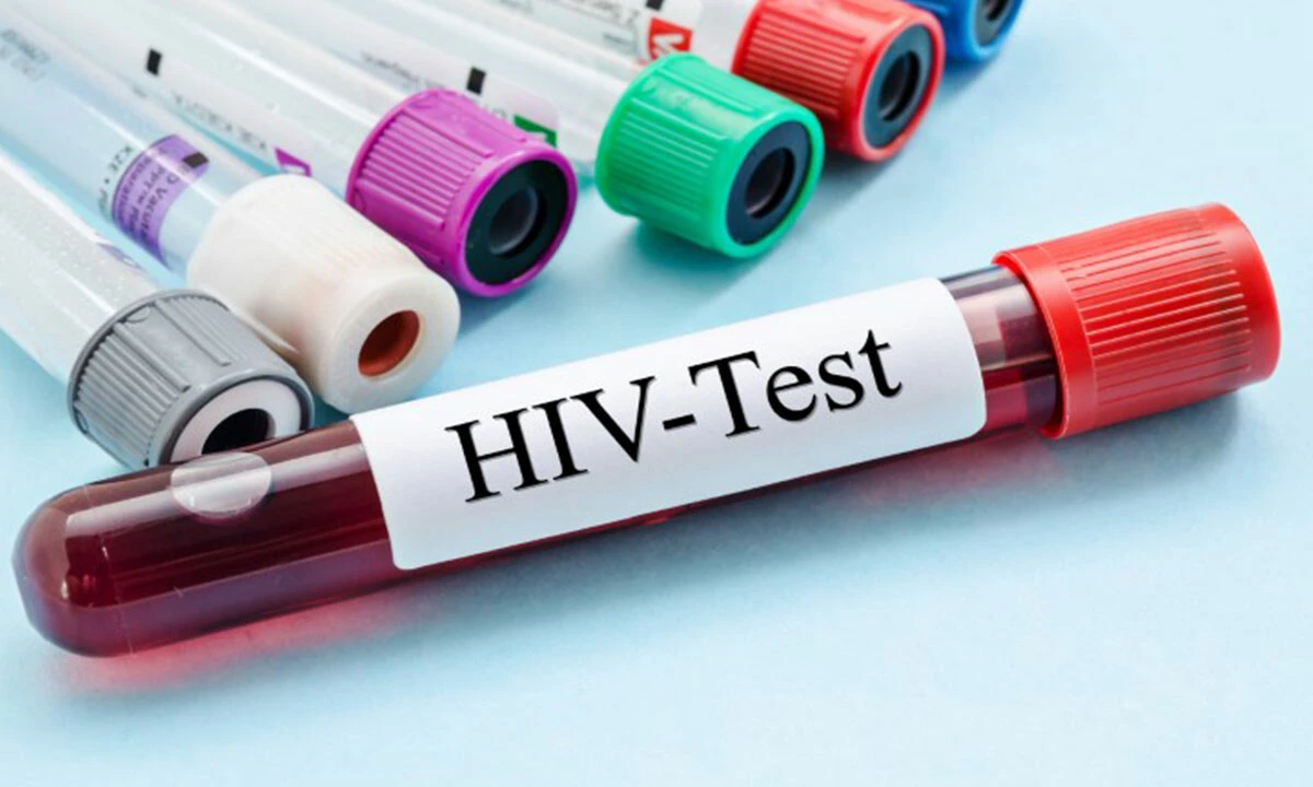 Çok daha öldürücü HIV varyantı bulundu