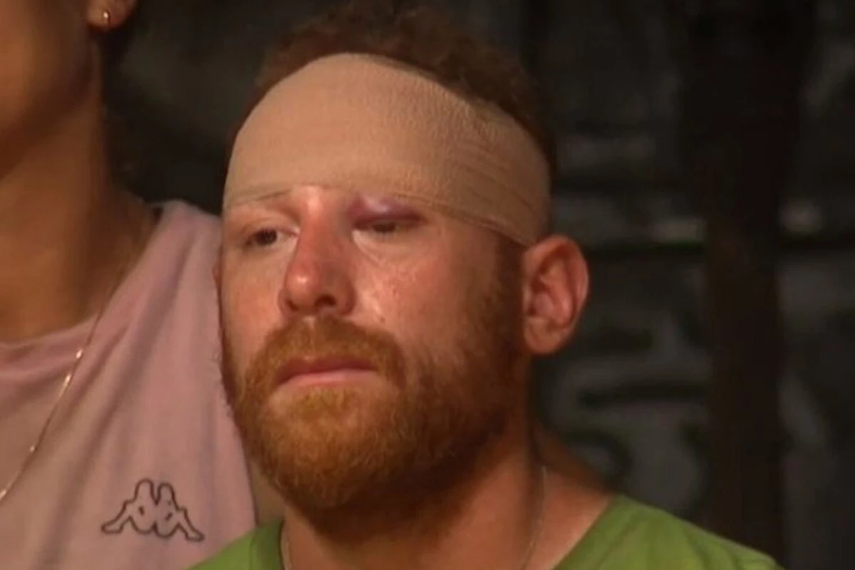 Furkan Kızılay kimdir? Survivor’dan elenen Furkan Kızılay’ın sağlık durumu nasıl?