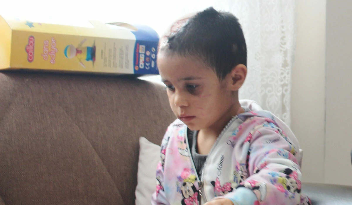 Asiye Ateş’in pitbull saldırısı davasında 4 tahliye! Mahkemede şaşkına çeviren ifadeler