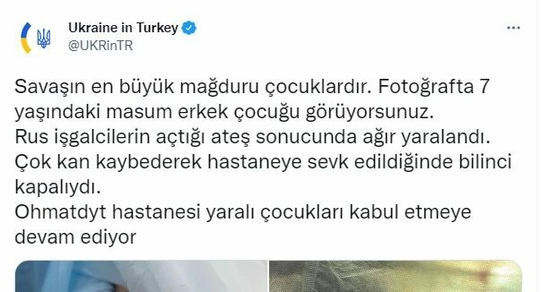 Ukrayna Büyükelçiliği'nden en acı paylaşım: Hani sivilleri vurmuyordunuz?