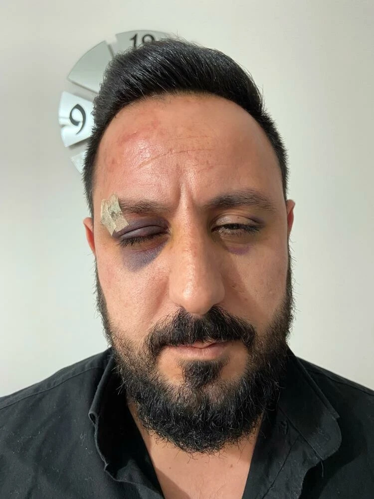 “Kime geldiniz” dedi öldüresiye dayak yedi: Dehşet anları kamerada