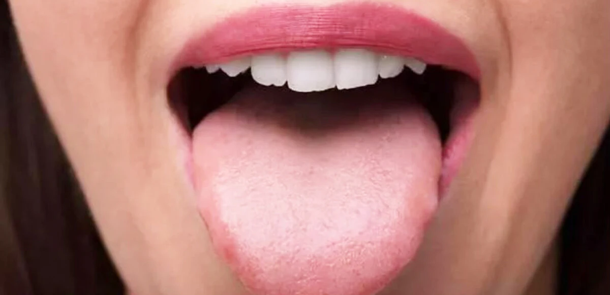 Dilinize bakın hastalığınızı anlayın!