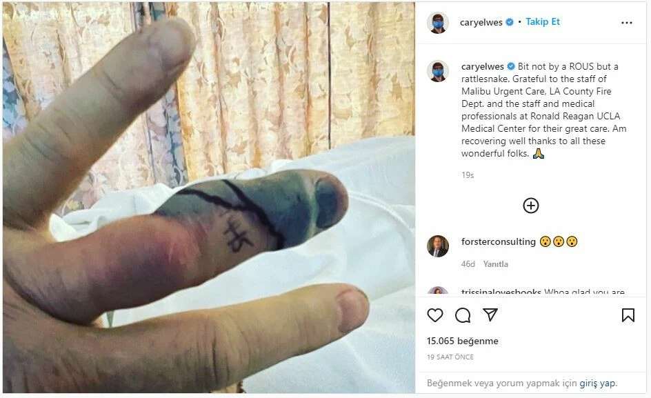 Cary Elwes'i evinde çıngıraklı yılan ısırdı