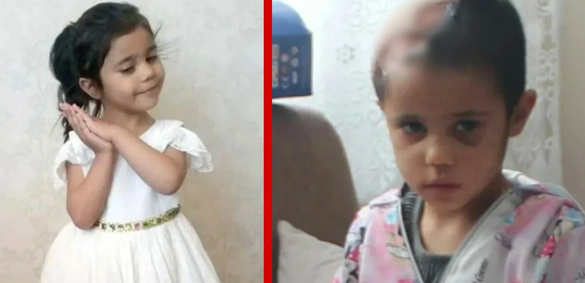 Pitbulların saldırdığı minik Asiye ölümden dönmüştü! Tutuklu sanıklara tahliye kararı