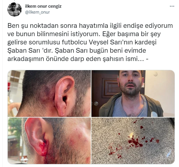 Ünlü futbolcunun kardeşinden kiracısına darp! ‘Evi boşalt, otel yapacağım’