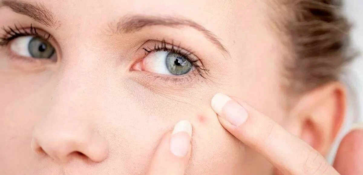 Duyan soğanın suyunu çıkarıyor: Uzun saçın şifresi, adet sancısının reçetesi, soğan suyunun 6 faydası