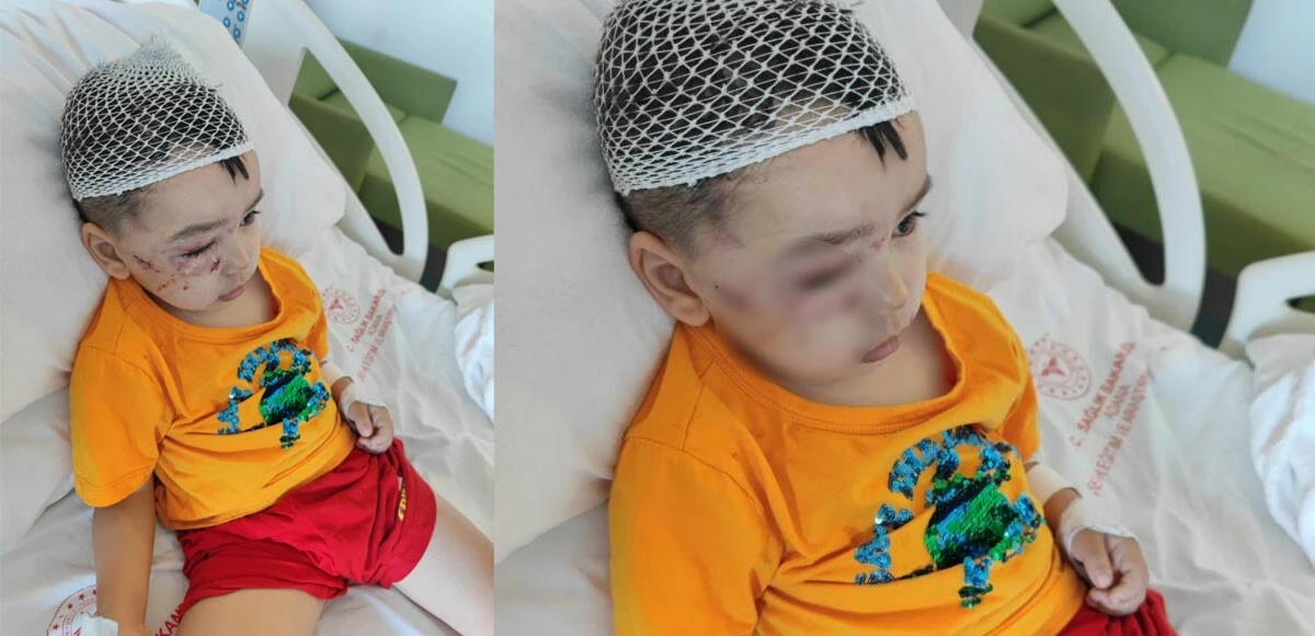 Köpek güzellik yarışmasında dehşet: Ağaca zincirli köpek 3 yaşındaki çocuğun yüzünü parçaladı