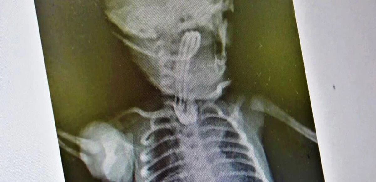 Binde bir görülüyor! 3 günlükken <a href=