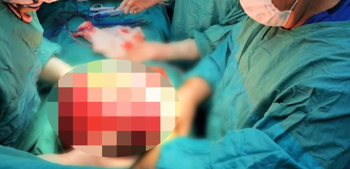 Doktorlar bile şaşkınlığını gizleyemedi! Genç kızın karnından 5 kiloluk kitle çıktı