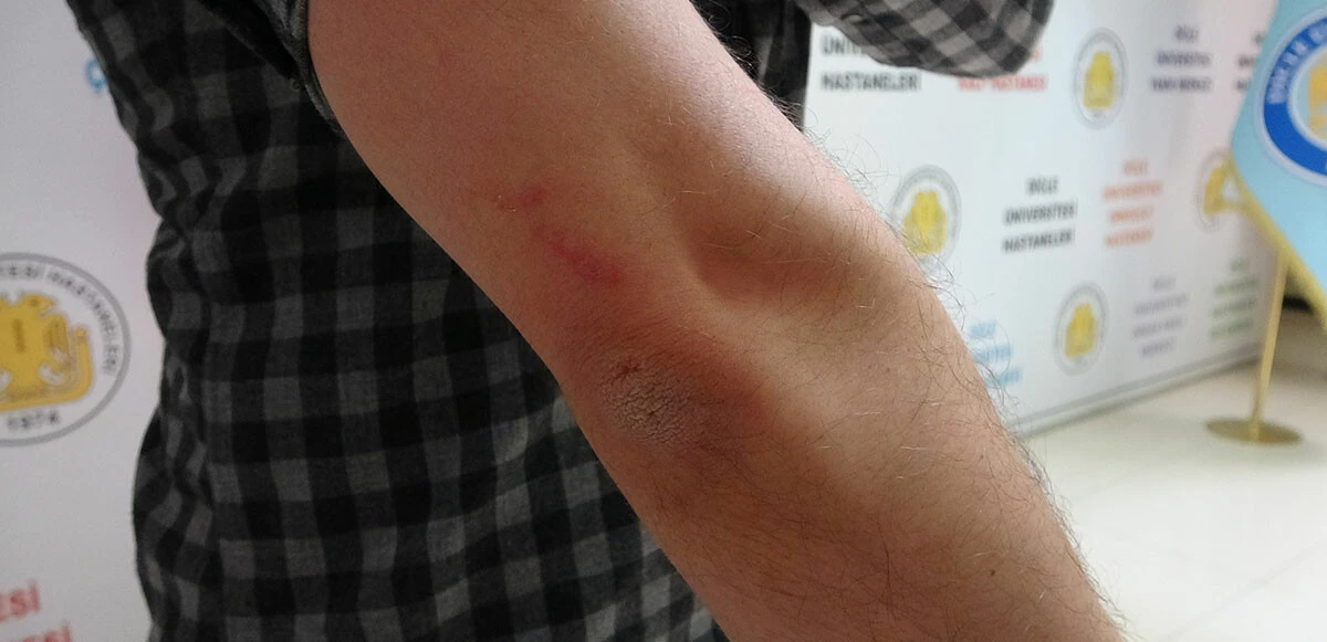 Diyarbakır'da darp edilen doktor o anları anlattı: Boğazım sıkıldı yumruklar savurdu