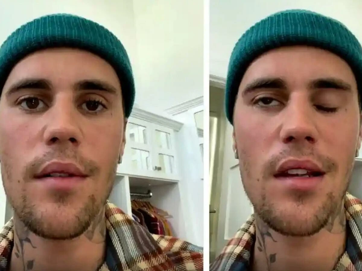 Yüz felci geçiren Justin Bieber'ın son sağlık durumu! 'Korkunç bir fırtına'