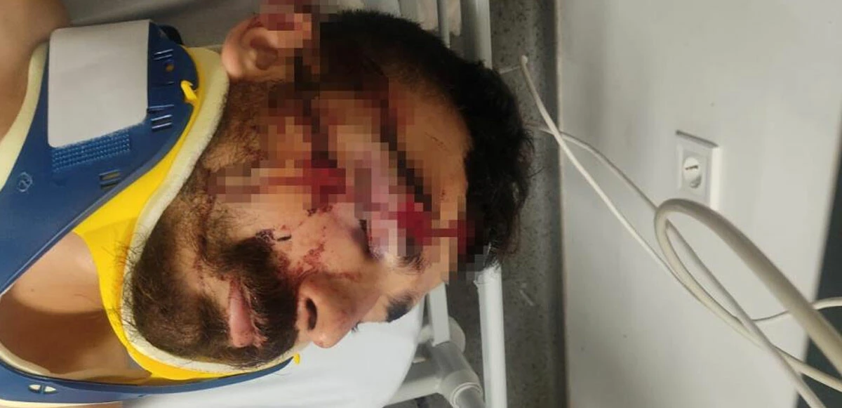 ‘Cana geleceğine mala gelsin’ demediler, dövüp kaçtılar! ‘Öldü zannettik’ deyip serbest kaldılar