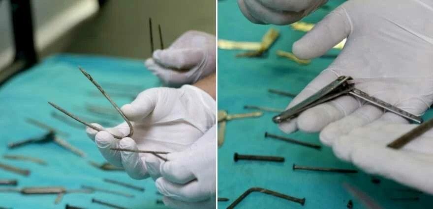 Van'da şoke eden olay! Midesinden neler çıkmadı ki: Çakı, iğne, anahtar, cımbız, çivi, tırnak makası...