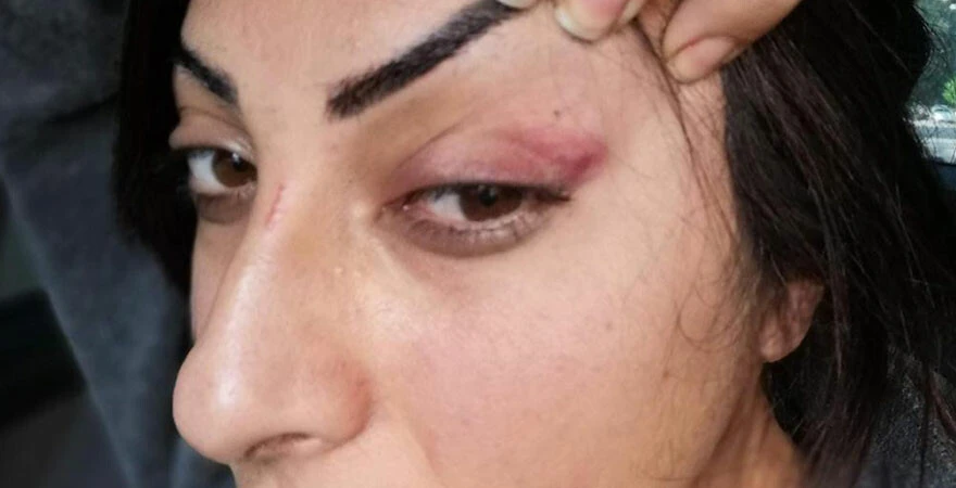 Öz annesi küçükken sattı, eşi yıllarca şiddet uyguladı! Genç kadın çocuklarını görmek için yardım istedi