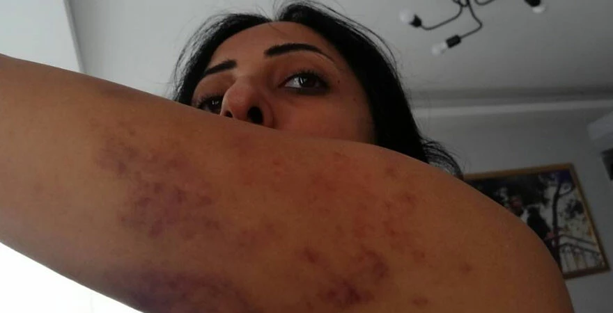 Öz annesi küçükken sattı, eşi yıllarca şiddet uyguladı! Genç kadın çocuklarını görmek için yardım istedi