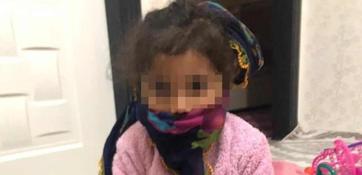 Sosyal medyada infiale neden oldu! Pitbull saldırısına uğrayan minik Asiye'ye annesinden psikolojik şiddet