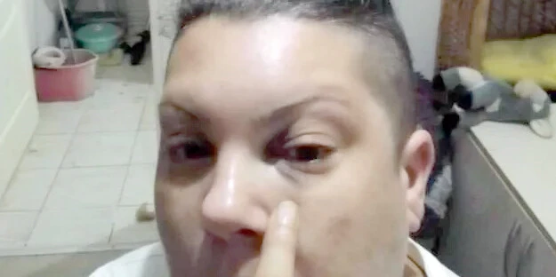 Eski Popstar yarışmacısı evinin önünde darp edildi! Şarkıcı Evren Mevlanaoğlu saldırıya uğradı