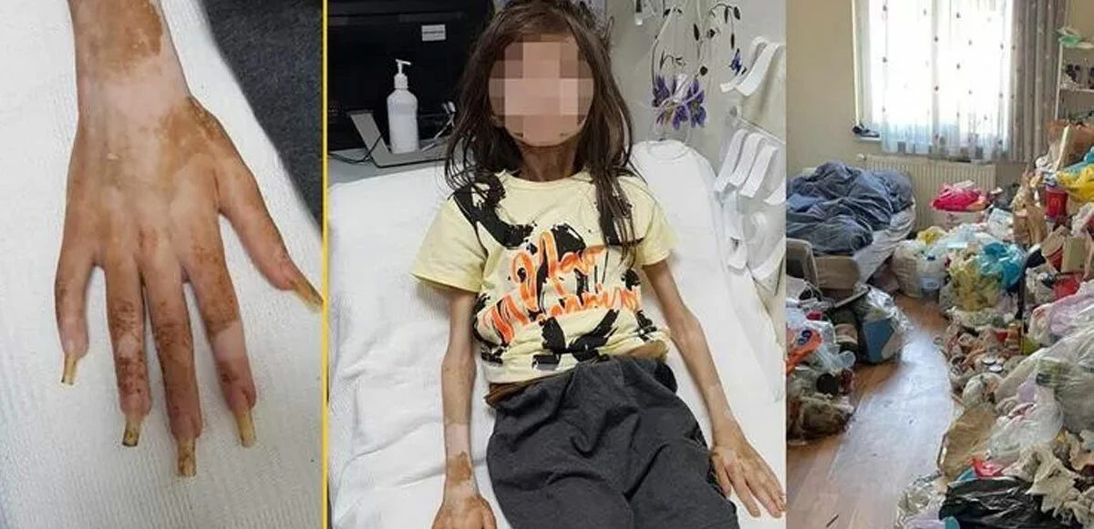 Çöp evdeki çocuğun doktorundan güzel haberler peş peşe: Yakında taburcu olacak