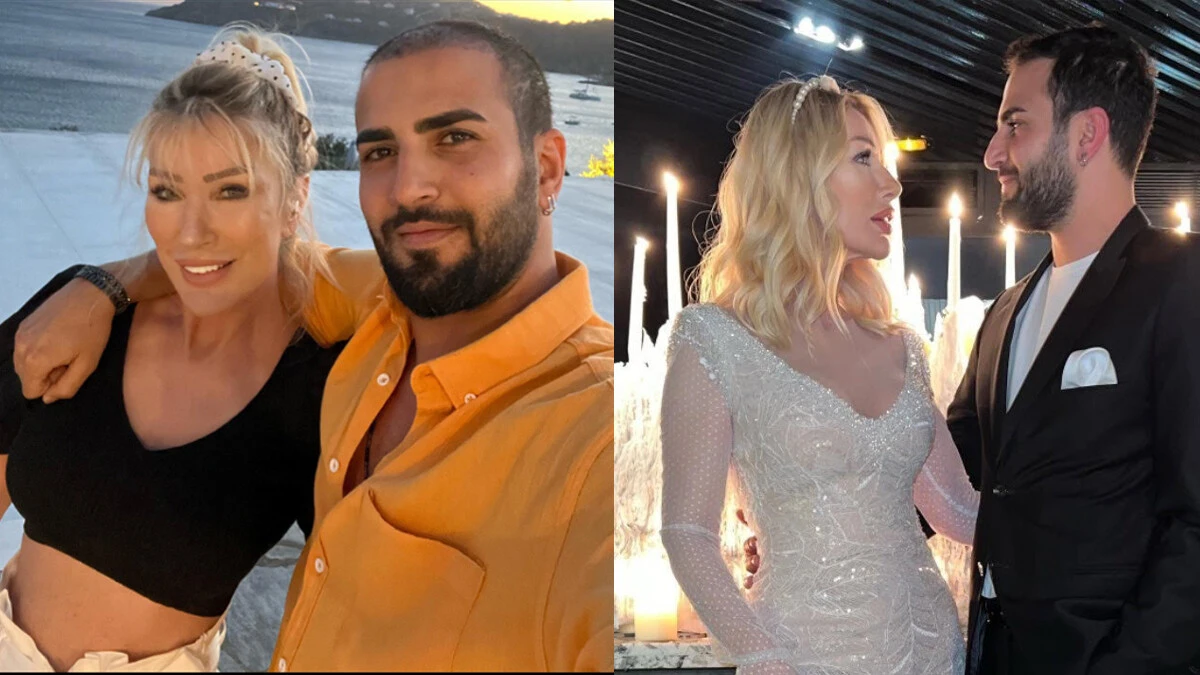 Seda Sayan'ın eşi Çağlar Ökten'in uzun saçlı hali şaşırttı! Doğum günü hediyesi saç ekimiydi