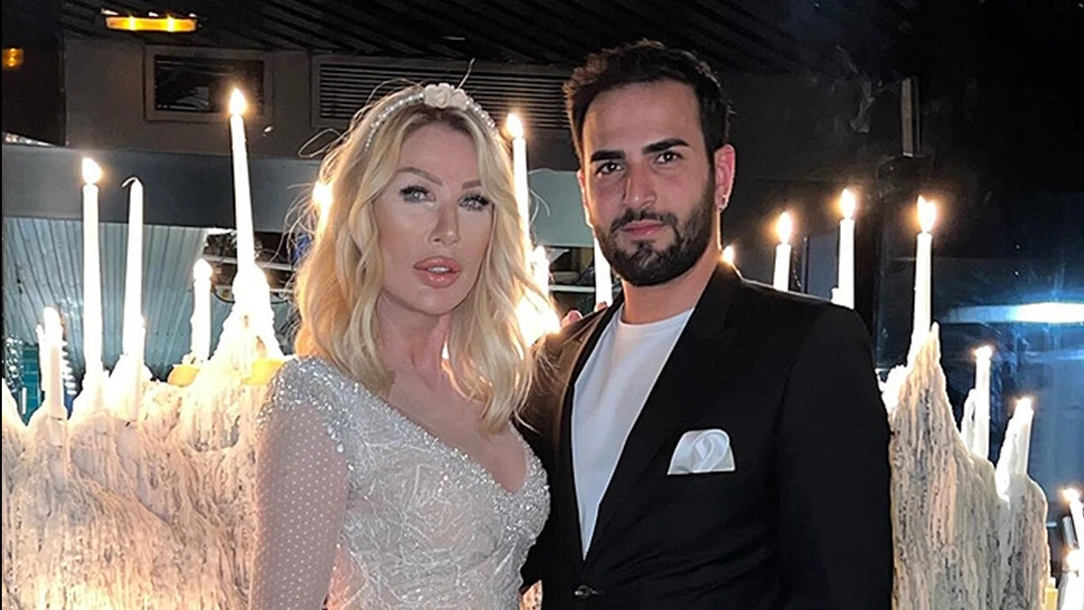 Seda Sayan'ın eşi Çağlar Ökten'in uzun saçlı hali şaşırttı! Doğum günü hediyesi saç ekimiydi