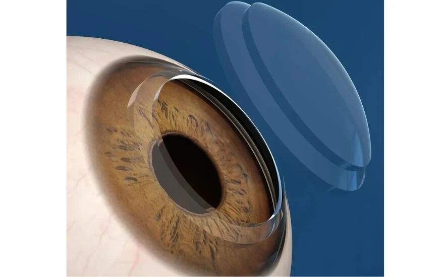 Uzmandan hayati uyarı: Bu uyku pozisyonu sizi kör edebiliyor, özellikle genç yaşlarda meydana geliyor