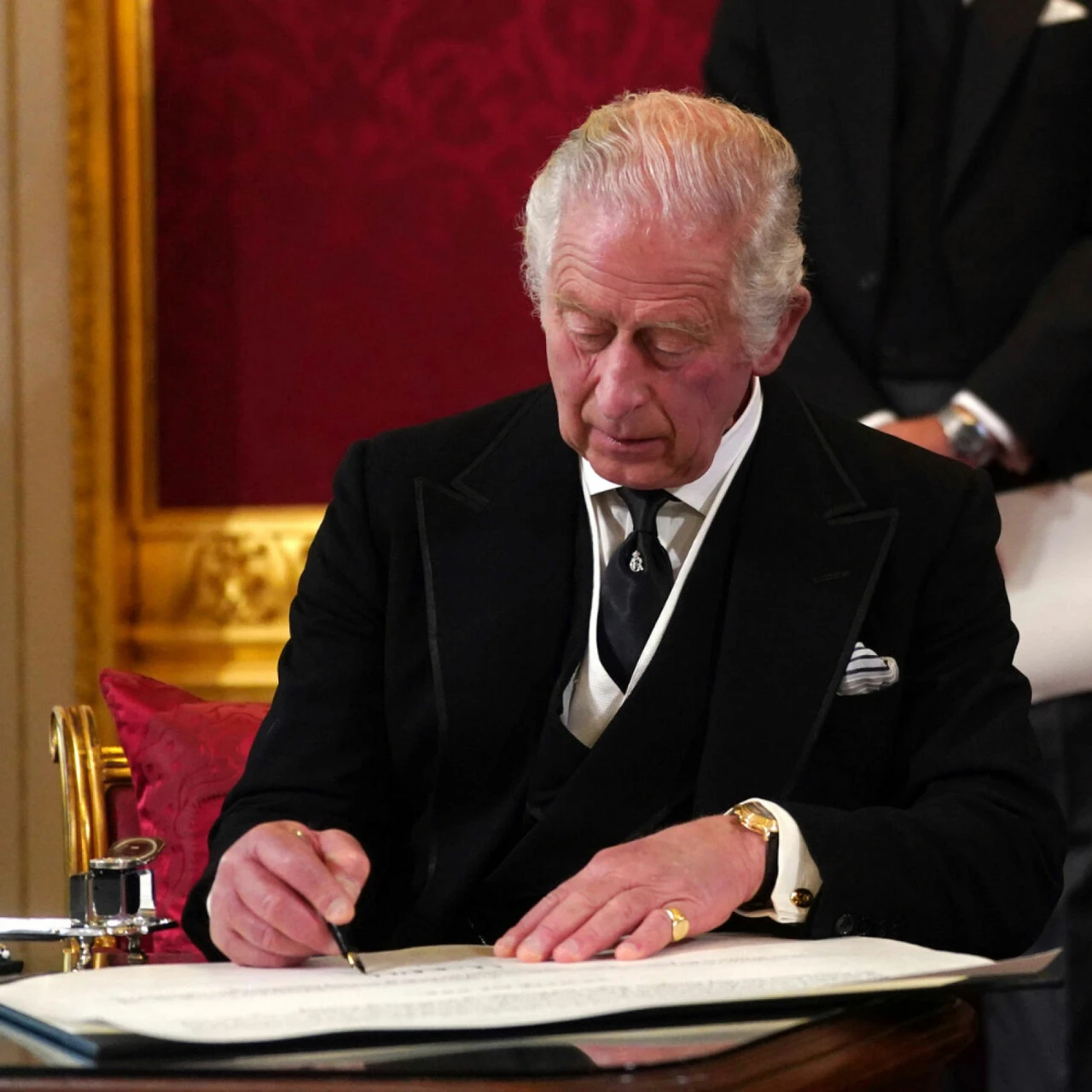 Yeni Kral Charles'ın son hali endişe uyandırdı! Şişen parmakları sosyal medyanın diline düştü