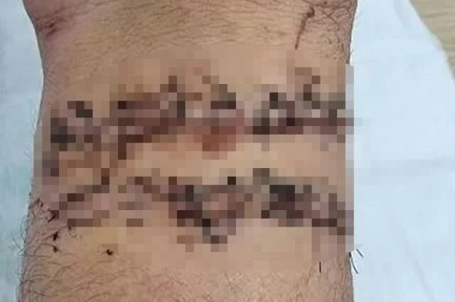 Yakalamak için gittiği yılan bileğini kopardı! Tek hamlesi yetti