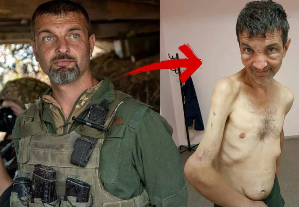 Esir düşen Ukraynalı askerin eski halinden eser yok! Takasla kurtulan askerin son hali dehşete düşürdü