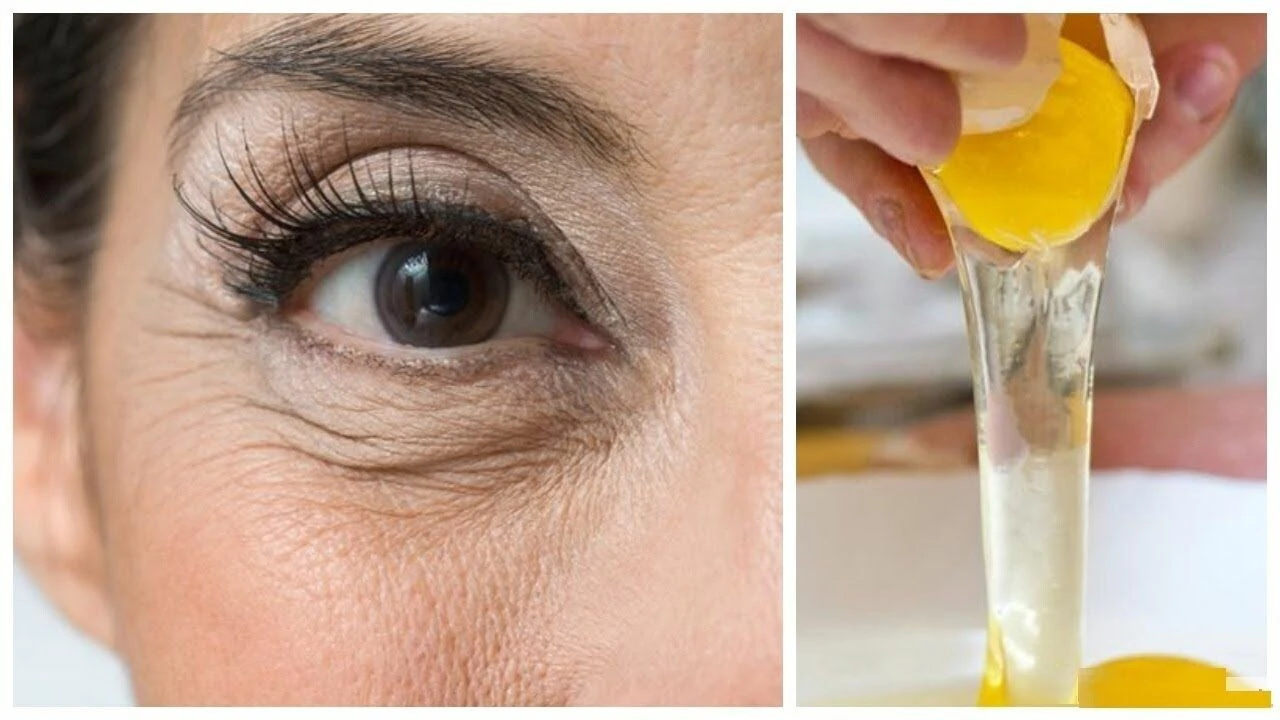 Limon Yüze Sürülür Mü? Limonun Cilde Faydaları Neler?