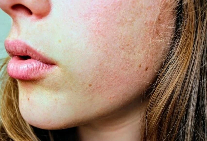 Hangi cilt hangi yağı kullanmalı? Karma, yağlı, kızarık ve kuru cilt tiplerine göre doğal, iyileştirici yağ çeşitleri