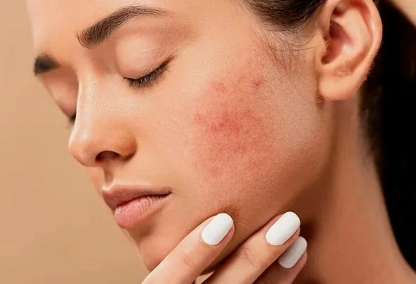 Hangi cilt hangi yağı kullanmalı? Karma, yağlı, kızarık ve kuru cilt tiplerine göre doğal, iyileştirici yağ çeşitleri