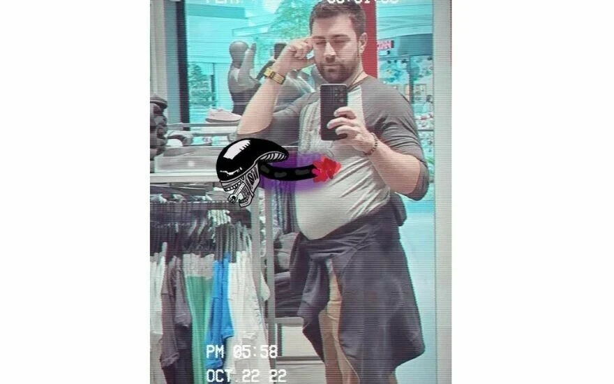 Çağlar Ertuğrul’un son halini görenler inanamadı: “Bu ne hal resmen göbek şov”