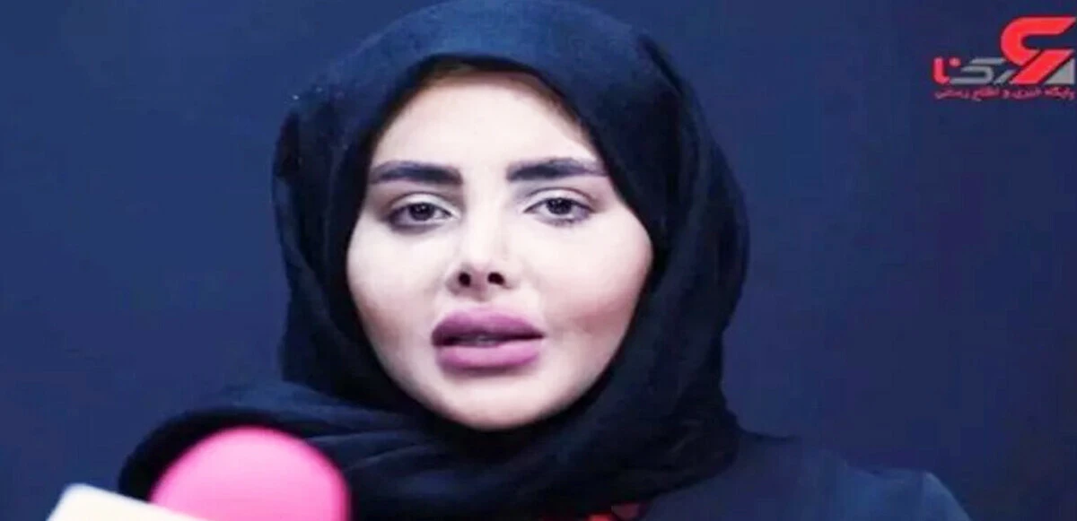 'Zombi Angelina'nın gerçek yüzü ortaya çıktı, meğer milyonları kandırmış